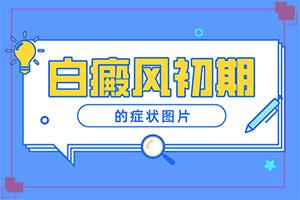 「白癜风初期怎样治疗」需要什么方法治疗？如何及时治疗