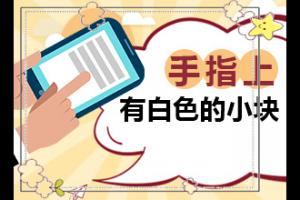 很正常皮肤一样的生来就有的白斑是健康的吗？诊断对比